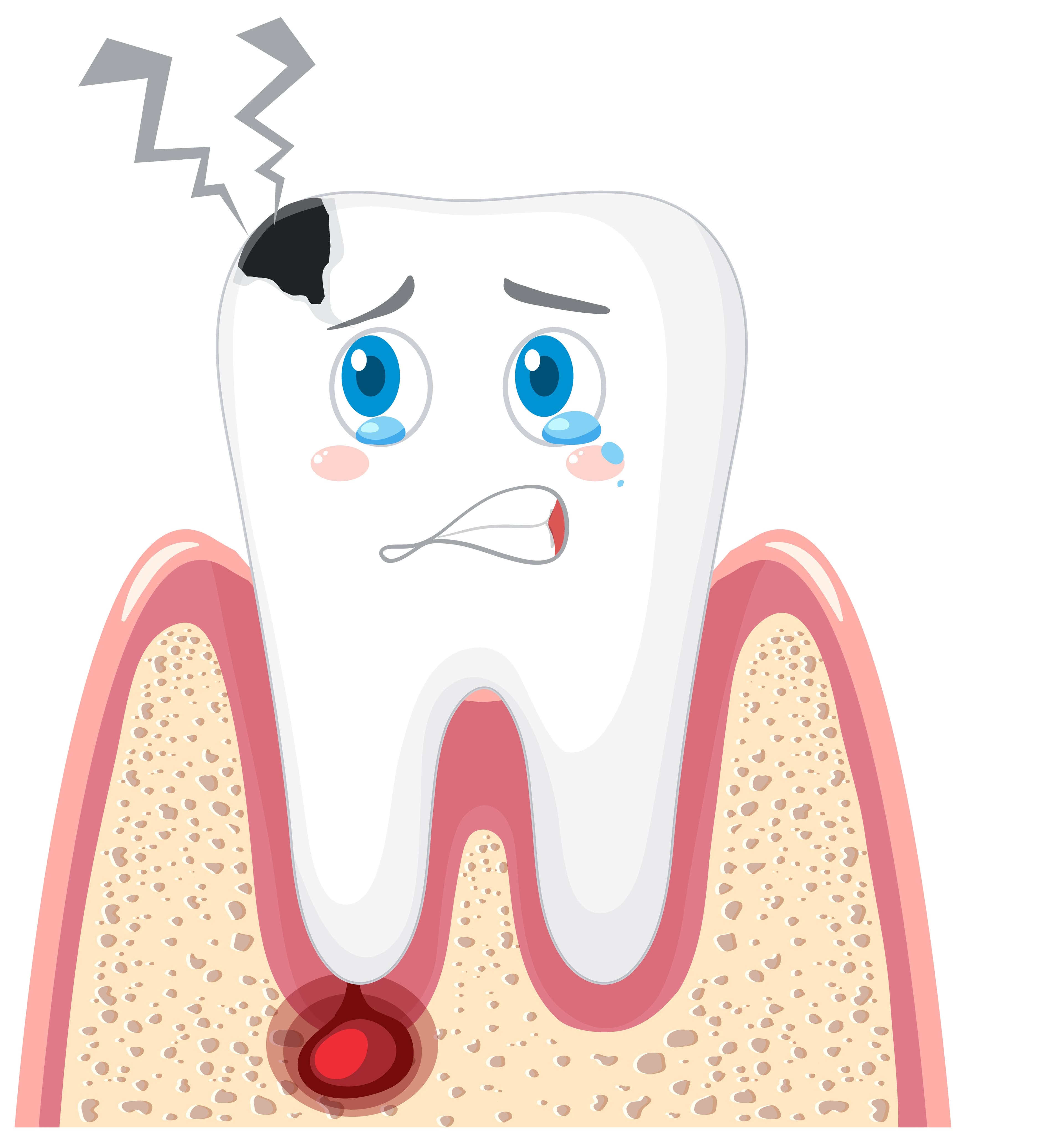 Root Canal Therapy — Pain-Free & Efficient