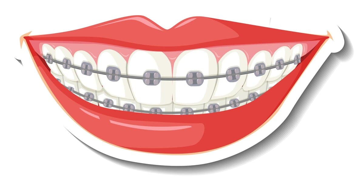 Orthodontics — Braces & Clear Aligners